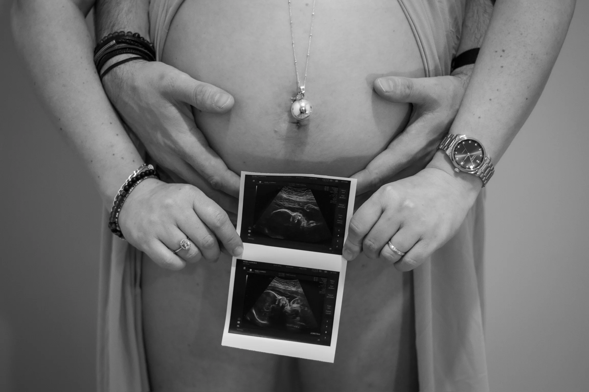 Photo de présentation de Grossesse Clémence